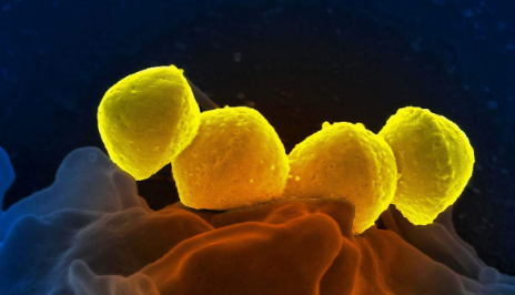 DARPA揭示了将在HEALR项目下针对超级细菌的团队